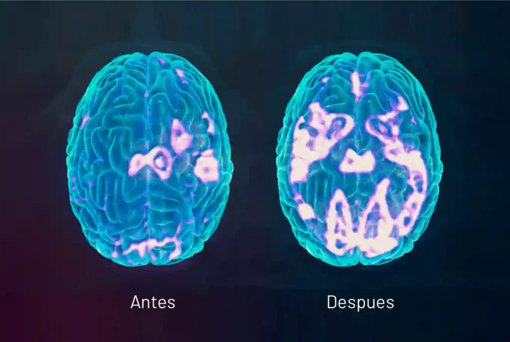 eeg advance neuro center barcelona mert
